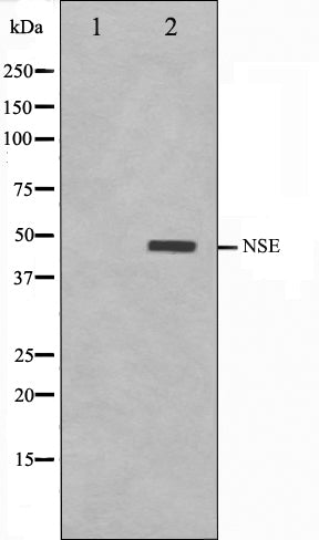 Western blot analysis on HepG2 cell lysate using NSE Antibody. The lane on the left is treated with the antigen-specific peptide.