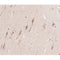 AF0223 at 1/100 staining human brain tissue sections by IHC-P. The tissue was formaldehyde fixed and a heat mediated antigen retrieval step in citrate buffer was performed. The tissue was then blocked and incubated with the antibody for 1.5 hours at 22¡ãC. An HRP conjugated goat anti-rabbit antibody was used as the secondary