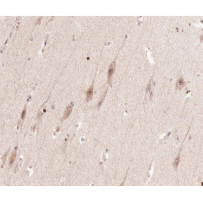 AF0223 at 1/100 staining human brain tissue sections by IHC-P. The tissue was formaldehyde fixed and a heat mediated antigen retrieval step in citrate buffer was performed. The tissue was then blocked and incubated with the antibody for 1.5 hours at 22¡ãC. An HRP conjugated goat anti-rabbit antibody was used as the secondary