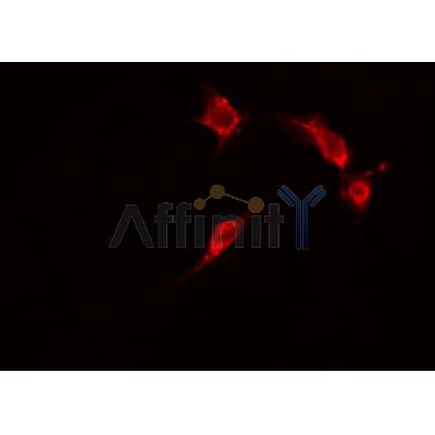 AF0223 staining HepG2 cells by IF/ICC. The sample were fixed with PFA and permeabilized in 0.1% Triton X-100,then blocked in 10% serum for 45 minutes at 25¡ãC. The primary antibody was diluted at 1/200 and incubated with the sample for 1 hour at 37¡ãC. An  Alexa Fluor 594 conjugated goat anti-rabbit IgG (H+L) antibody(Cat.