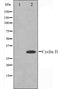 Western blot analysis on HeLa cell lysate using Cyclin H Antibody.The lane on the left is treated with the antigen-specific peptide.