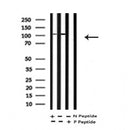 AF7281 at 1/100 staining mouse lung tissue sections by IHC-P. The tissue was formaldehyde fixed and a heat mediated antigen retrieval step in citrate buffer was performed. The tissue was then blocked and incubated with the antibody for 1.5 hours at 22¡ãC. An HRP conjugated goat anti-rabbit antibody was used as the secondary