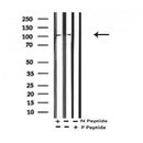 AF7283 at 1/100 staining human lung cancer tissue sections by IHC-P. The tissue was formaldehyde fixed and a heat mediated antigen retrieval step in citrate buffer was performed. The tissue was then blocked and incubated with the antibody for 1.5 hours at 22¡ãC. An HRP conjugated goat anti-rabbit antibody was used as the secondary