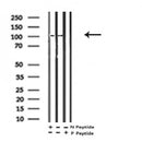 AF7284 at 1/100 staining rat lung tissue sections by IHC-P. The tissue was formaldehyde fixed and a heat mediated antigen retrieval step in citrate buffer was performed. The tissue was then blocked and incubated with the antibody for 1.5 hours at 22¡ãC. An HRP conjugated goat anti-rabbit antibody was used as the secondary