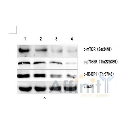 Western blot analysis of Phospho-p70 S6 Kinase (Thr389/412)   using various lysates   Lanes 1 - 2: Merged signal (red and green). Green - AF3228 observed at 70 kDa. Red - loading control, T0023, observed at 55 kDa.   Blots were developed with Goat Anti-Rabbit IgG(H+L) FITC–conjugated (S0008) and Goat Anti-Mouse IgG(H+L) Alexa Fluor 594–conjugated  (S0005) secondary antibodies