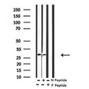 AF7290 at 1/100 staining human lung cancer tissue sections by IHC-P. The tissue was formaldehyde fixed and a heat mediated antigen retrieval step in citrate buffer was performed. The tissue was then blocked and incubated with the antibody for 1.5 hours at 22¡ãC. An HRP conjugated goat anti-rabbit antibody was used as the secondary