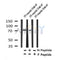 AF7291 at 1/100 staining human gastric cancer tissue sections by IHC-P. The tissue was formaldehyde fixed and a heat mediated antigen retrieval step in citrate buffer was performed. The tissue was then blocked and incubated with the antibody for 1.5 hours at 22¡ãC. An HRP conjugated goat anti-rabbit antibody was used as the secondary