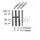 AF7292 at 1/100 staining human gastric cancer tissue sections by IHC-P. The tissue was formaldehyde fixed and a heat mediated antigen retrieval step in citrate buffer was performed. The tissue was then blocked and incubated with the antibody for 1.5 hours at 22¡ãC. An HRP conjugated goat anti-rabbit antibody was used as the secondary