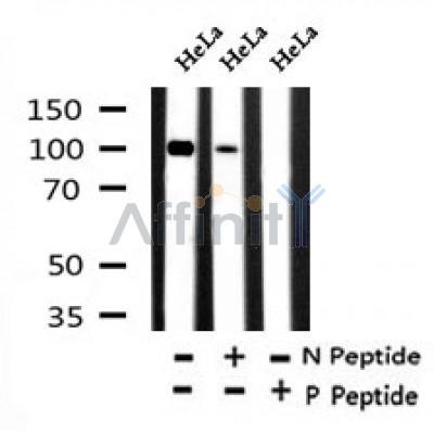 Western blot analysis of Phospho-CTNNA1 (Tyr177) in lysates of HeLa?, using Phospho-CTNNA1 (Tyr177) Antibody(AF7295).