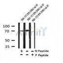 AF7296 at 1/100 staining human lung cancer tissue sections by IHC-P. The tissue was formaldehyde fixed and a heat mediated antigen retrieval step in citrate buffer was performed. The tissue was then blocked and incubated with the antibody for 1.5 hours at 22¡ãC. An HRP conjugated goat anti-rabbit antibody was used as the secondary