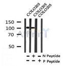 AF7302 at 1/100 staining human gastric cancer tissue sections by IHC-P. The tissue was formaldehyde fixed and a heat mediated antigen retrieval step in citrate buffer was performed. The tissue was then blocked and incubated with the antibody for 1.5 hours at 22¡ãC. An HRP conjugated goat anti-rabbit antibody was used as the secondary