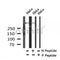 AF7303 at 1/100 staining human gastric cancer tissue sections by IHC-P. The tissue was formaldehyde fixed and a heat mediated antigen retrieval step in citrate buffer was performed. The tissue was then blocked and incubated with the antibody for 1.5 hours at 22¡ãC. An HRP conjugated goat anti-rabbit antibody was used as the secondary