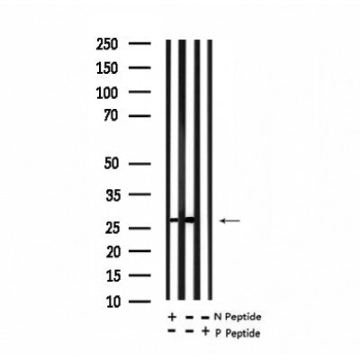 Western blot analysis of extracts of Mouse heart tissue sample,using Phospho-TNNI3 (Ser22+Ser23) Antibody(AF7307).