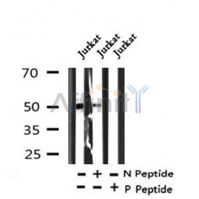 Western blot analysis of Phospho -Arrestin 1 (Tyr173) in lysates of Jurkat?, using Phospho -Arrestin 1 (Tyr173) Antibody(AF7310).