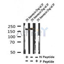 AF7312 at 1/100 staining rat brain tissue sections by IHC-P. The tissue was formaldehyde fixed and a heat mediated antigen retrieval step in citrate buffer was performed. The tissue was then blocked and incubated with the antibody for 1.5 hours at 22¡ãC. An HRP conjugated goat anti-rabbit antibody was used as the secondary