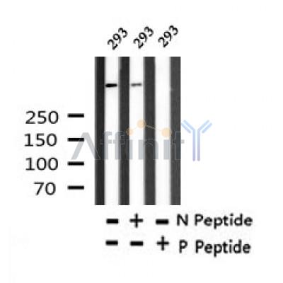 AF7317 at 1/100 staining human spleen tissue sections by IHC-P. The tissue was formaldehyde fixed and a heat mediated antigen retrieval step in citrate buffer was performed. The tissue was then blocked and incubated with the antibody for 1.5 hours at 22¡ãC. An HRP conjugated goat anti-rabbit antibody was used as the secondary