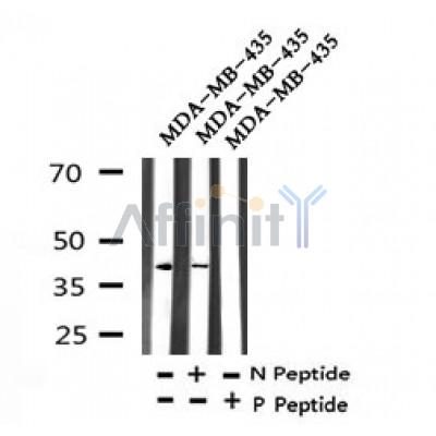 Western blot analysis of Phospho-MKK6 (Thr28) in lysates of MDA-MB-435, using Phospho-MKK6 (Thr28) Antibody(AF7320).