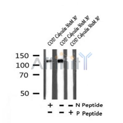 Western blot analysis of Phospho-ATP-Citrate Lyase (Ser447) in lysates of COS7 Calyculin 50nM 30', using Phospho-ATP-Citrate Lyase (Ser447) Antibody(AF7323).
