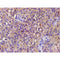 AF3232 staining COLO205 by IF/ICC. The sample were fixed with PFA and permeabilized in 0.1% Triton X-100,then blocked in 10% serum for 45 minutes at 25¡ãC. The primary antibody was diluted at 1/200 and incubated with the sample for 1 hour at 37¡ãC. An  Alexa Fluor 594 conjugated goat anti-rabbit IgG (H+L) Ab, diluted at 1/600, was used as the secondary antibod