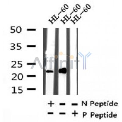 AF7330 at 1/100 staining human liver tissue sections by IHC-P. The tissue was formaldehyde fixed and a heat mediated antigen retrieval step in citrate buffer was performed. The tissue was then blocked and incubated with the antibody for 1.5 hours at 22¡ãC. An HRP conjugated goat anti-rabbit antibody was used as the secondary