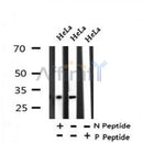 AF7331 at 1/100 staining human kidney tissue sections by IHC-P. The tissue was formaldehyde fixed and a heat mediated antigen retrieval step in citrate buffer was performed. The tissue was then blocked and incubated with the antibody for 1.5 hours at 22¡ãC. An HRP conjugated goat anti-rabbit antibody was used as the secondary