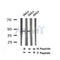 AF7334 at 1/100 staining human lung cancer tissue sections by IHC-P. The tissue was formaldehyde fixed and a heat mediated antigen retrieval step in citrate buffer was performed. The tissue was then blocked and incubated with the antibody for 1.5 hours at 22¡ãC. An HRP conjugated goat anti-rabbit antibody was used as the secondary