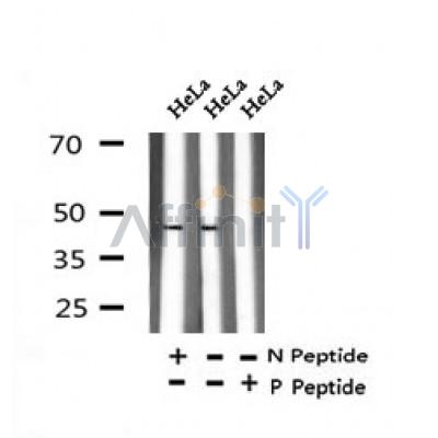 AF7334 at 1/100 staining human lung cancer tissue sections by IHC-P. The tissue was formaldehyde fixed and a heat mediated antigen retrieval step in citrate buffer was performed. The tissue was then blocked and incubated with the antibody for 1.5 hours at 22¡ãC. An HRP conjugated goat anti-rabbit antibody was used as the secondary