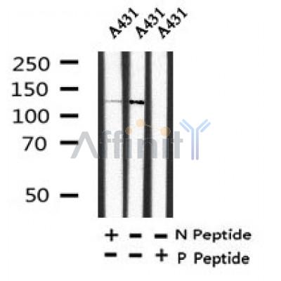 AF7343 at 1/100 staining human liver tissue sections by IHC-P. The tissue was formaldehyde fixed and a heat mediated antigen retrieval step in citrate buffer was performed. The tissue was then blocked and incubated with the antibody for 1.5 hours at 22¡ãC. An HRP conjugated goat anti-rabbit antibody was used as the secondary