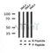 AF7344 at 1/100 staining human gastric cancer tissue sections by IHC-P. The tissue was formaldehyde fixed and a heat mediated antigen retrieval step in citrate buffer was performed. The tissue was then blocked and incubated with the antibody for 1.5 hours at 22¡ãC. An HRP conjugated goat anti-rabbit antibody was used as the secondary