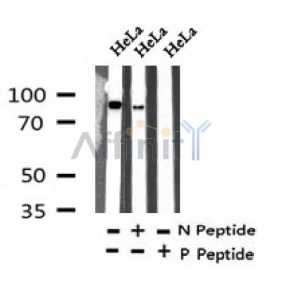 Western blot analysis of Phospho-PKC  (Thr710) in lysates of HeLa , using Phospho-PKC  (Thr710) Antibody(AF7345).