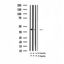 AF7346 at 1/100 staining human kidney tissue sections by IHC-P. The tissue was formaldehyde fixed and a heat mediated antigen retrieval step in citrate buffer was performed. The tissue was then blocked and incubated with the antibody for 1.5 hours at 22¡ãC. An HRP conjugated goat anti-rabbit antibody was used as the secondary