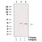 AF3234 staining MCF7 by IF/ICC. The sample were fixed with PFA and permeabilized in 0.1% Triton X-100,then blocked in 10% serum for 45 minutes at 25¡ãC. The primary antibody was diluted at 1/200 and incubated with the sample for 1 hour at 37¡ãC. An  Alexa Fluor 594 conjugated goat anti-rabbit IgG (H+L) Ab, diluted at 1/600, was used as the secondary antibod