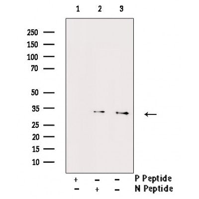 AF3234 staining MCF7 by IF/ICC. The sample were fixed with PFA and permeabilized in 0.1% Triton X-100,then blocked in 10% serum for 45 minutes at 25¡ãC. The primary antibody was diluted at 1/200 and incubated with the sample for 1 hour at 37¡ãC. An  Alexa Fluor 594 conjugated goat anti-rabbit IgG (H+L) Ab, diluted at 1/600, was used as the secondary antibod