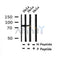 AF7355 at 1/100 staining human gastric cancer tissue sections by IHC-P. The tissue was formaldehyde fixed and a heat mediated antigen retrieval step in citrate buffer was performed. The tissue was then blocked and incubated with the antibody for 1.5 hours at 22¡ãC. An HRP conjugated goat anti-rabbit antibody was used as the secondary