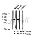 Western blot analysis of Phospho-DDR1 (Tyr520) in lysates of HepG2 , using Phospho-DDR1 (Tyr520) Antibody(AF7361).
