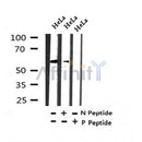 AF7363 at 1/100 staining human liver tissue sections by IHC-P. The tissue was formaldehyde fixed and a heat mediated antigen retrieval step in citrate buffer was performed. The tissue was then blocked and incubated with the antibody for 1.5 hours at 22¡ãC. An HRP conjugated goat anti-rabbit antibody was used as the secondary