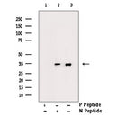 AF3236 staining A2780 by IF/ICC. The sample were fixed with PFA and permeabilized in 0.1% Triton X-100,then blocked in 10% serum for 45 minutes at 25¡ãC. The primary antibody was diluted at 1/200 and incubated with the sample for 1 hour at 37¡ãC. An  Alexa Fluor 594 conjugated goat anti-rabbit IgG (H+L) Ab, diluted at 1/600, was used as the secondary antibod