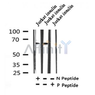AF7370 at 1/100 staining human liver tissue sections by IHC-P. The tissue was formaldehyde fixed and a heat mediated antigen retrieval step in citrate buffer was performed. The tissue was then blocked and incubated with the antibody for 1.5 hours at 22¡ãC. An HRP conjugated goat anti-rabbit antibody was used as the secondary