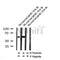 AF7374 at 1/100 staining human gastric cancer tissue sections by IHC-P. The tissue was formaldehyde fixed and a heat mediated antigen retrieval step in citrate buffer was performed. The tissue was then blocked and incubated with the antibody for 1.5 hours at 22¡ãC. An HRP conjugated goat anti-rabbit antibody was used as the secondary