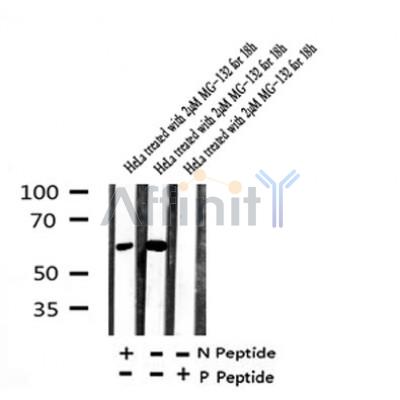 AF7374 at 1/100 staining human gastric cancer tissue sections by IHC-P. The tissue was formaldehyde fixed and a heat mediated antigen retrieval step in citrate buffer was performed. The tissue was then blocked and incubated with the antibody for 1.5 hours at 22¡ãC. An HRP conjugated goat anti-rabbit antibody was used as the secondary
