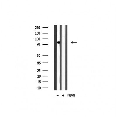 Western blot analysis of OCT1  expression in Mouse brain lysate
