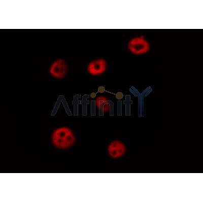 AF0224 staining HeLa by IF/ICC. The sample were fixed with PFA and permeabilized in 0.1% Triton X-100,then blocked in 10% serum for 45 minutes at 25¡ãC. The primary antibody was diluted at 1/200 and incubated with the sample for 1 hour at 37¡ãC. An  Alexa Fluor 594 conjugated goat anti-rabbit IgG (H+L) Ab, diluted at 1/600, was used as the secondary antibod