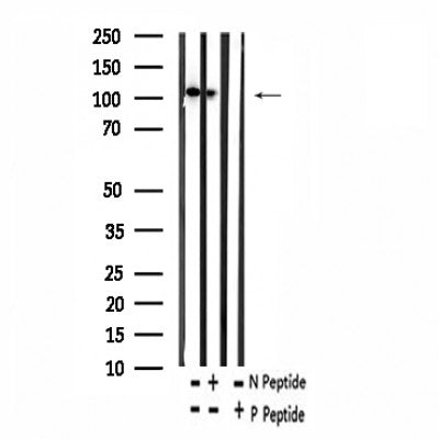 AF7384 at 1/100 staining human kidney tissue sections by IHC-P. The tissue was formaldehyde fixed and a heat mediated antigen retrieval step in citrate buffer was performed. The tissue was then blocked and incubated with the antibody for 1.5 hours at 22¡ãC. An HRP conjugated goat anti-rabbit antibody was used as the secondary