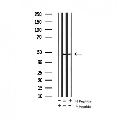 AF3238 at 1/100 staining Mouse intestine tissue by IHC-P. The sample was formaldehyde fixed and a heat mediated antigen retrieval step in citrate buffer was performed. The sample was then blocked and incubated with the antibody for 1.5 hours at 22¡ãC. An HRP conjugated goat anti-rabbit antibody was used as the secondary