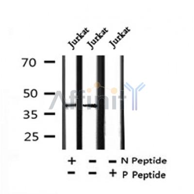 AF7392 at 1/100 staining human liver tissue sections by IHC-P. The tissue was formaldehyde fixed and a heat mediated antigen retrieval step in citrate buffer was performed. The tissue was then blocked and incubated with the antibody for 1.5 hours at 22¡ãC. An HRP conjugated goat anti-rabbit antibody was used as the secondary