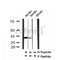 AF7397 at 1/100 staining human lung cancer tissue sections by IHC-P. The tissue was formaldehyde fixed and a heat mediated antigen retrieval step in citrate buffer was performed. The tissue was then blocked and incubated with the antibody for 1.5 hours at 22¡ãC. An HRP conjugated goat anti-rabbit antibody was used as the secondary