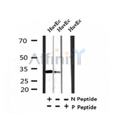 AF7397 at 1/100 staining human lung cancer tissue sections by IHC-P. The tissue was formaldehyde fixed and a heat mediated antigen retrieval step in citrate buffer was performed. The tissue was then blocked and incubated with the antibody for 1.5 hours at 22¡ãC. An HRP conjugated goat anti-rabbit antibody was used as the secondary