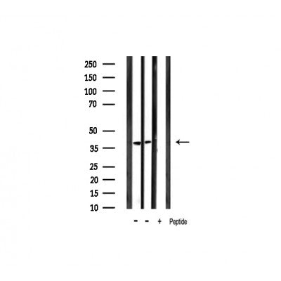 AF3239 staining MCF7 by IF/ICC. The sample were fixed with PFA and permeabilized in 0.1% Triton X-100,then blocked in 10% serum for 45 minutes at 25¡ãC. The primary antibody was diluted at 1/200 and incubated with the sample for 1 hour at 37¡ãC. An  Alexa Fluor 594 conjugated goat anti-rabbit IgG (H+L) Ab, diluted at 1/600, was used as the secondary antibod