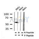 AF7398 at 1/100 staining rat liver tissue sections by IHC-P. The tissue was formaldehyde fixed and a heat mediated antigen retrieval step in citrate buffer was performed. The tissue was then blocked and incubated with the antibody for 1.5 hours at 22¡ãC. An HRP conjugated goat anti-rabbit antibody was used as the secondary