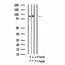 Western blot analysis of extracts from various samples, using Phospho-Trk C (Tyr705) Antibody.
 Lane 1: COS-7 uv treated, treated with blocking peptide;
 Lane 2: COS-7 uv treated;
 Lane 3: VERO heat shock treated.